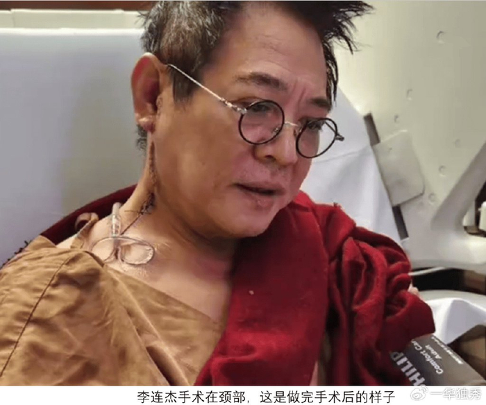 62岁李连杰住院切颈部肿瘤，自嘲“返厂维修”，再发“无常”感慨__财经头条__新浪财经