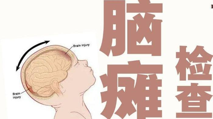 产检能查脑瘫儿吗？产检都正常为什么会生下脑瘫儿？医生这样解释