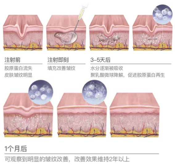 天津联合丽格高盛川院长童颜针效果怎么样?|玛吉|丽格|童颜_新浪新闻
