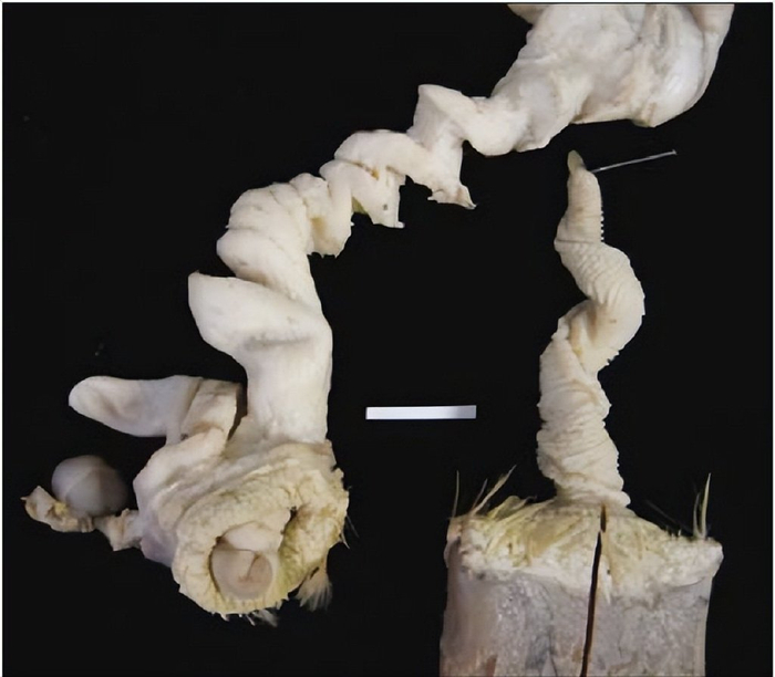 生殖器战争:被忽视的阴道|阴茎|雄性|布伦南_新浪新闻