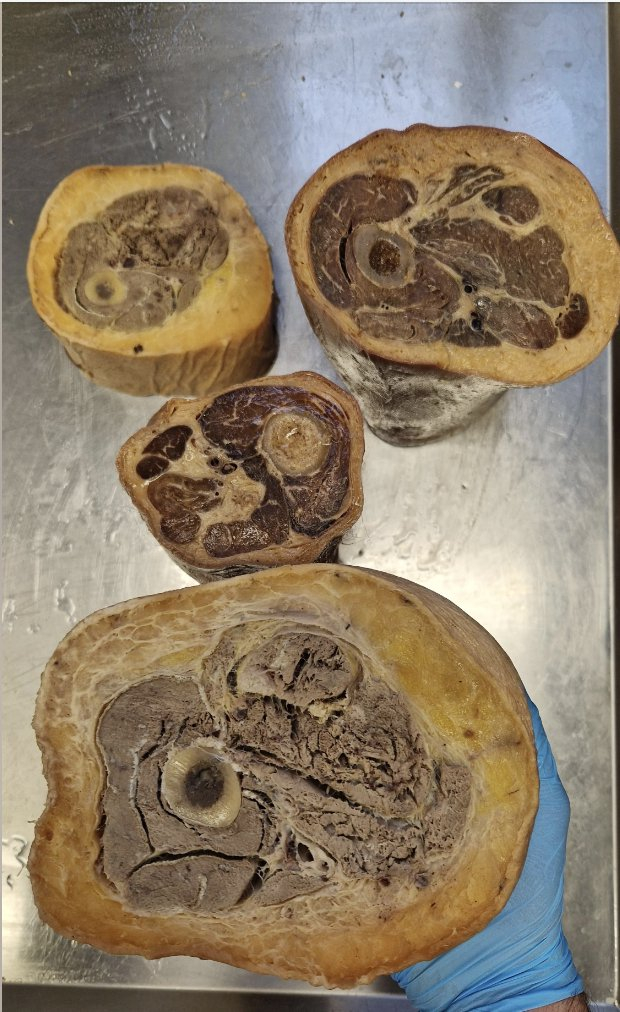 你可以看到肌肉和脂肪在大腿上的占比