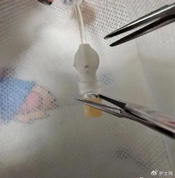 尾部后,用止液夹夹紧picc导管,再采用无菌镊子从肝素帽与picc尾部接缝