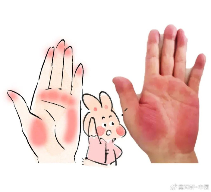 春天手上有这3种症状,说明肝在“求救”!一碗汤灭肝火,补肝血|肝气|指甲|桑叶_新浪新闻