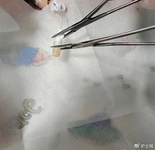 尾部后,用止液夹夹紧picc导管,再采用无菌镊子从肝素帽与picc尾部接缝