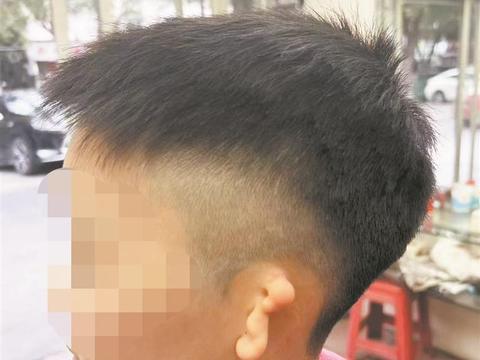 10岁男孩左耳重生