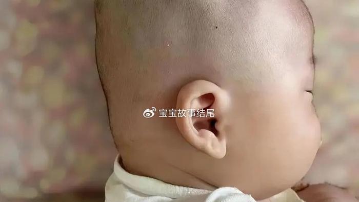 妈妈生下“扁平头”宝宝，家里乱作一团，医生笑了