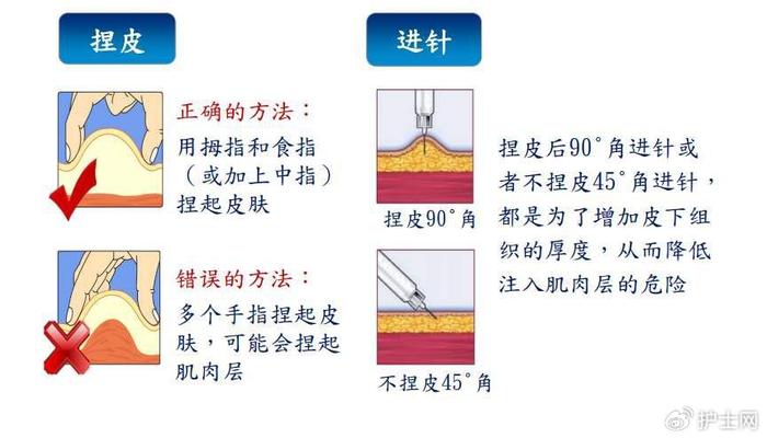 肝素大腿外侧注射图片图片