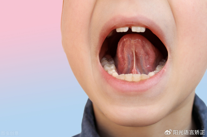 如果宝宝舌系带发育正常,那么当孩子伸舌时,他们的舌尖会呈现圆钝形态