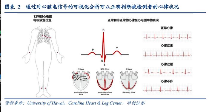 一,心脏电生理手术疗效明确,渗透率还有较大提升空间