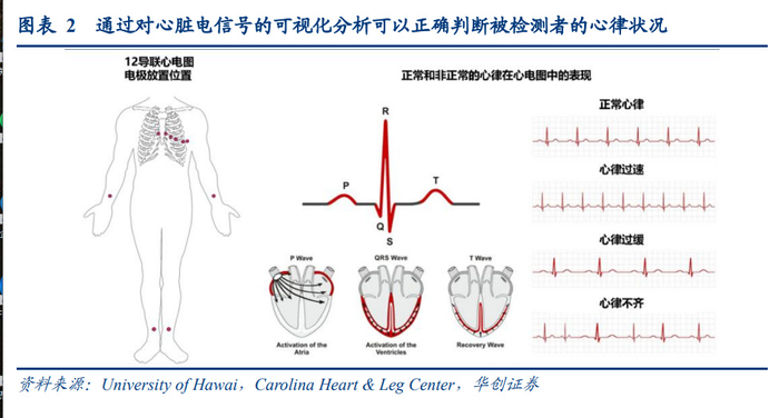 一,心脏电生理手术疗效明确,渗透率还有较大提升空间