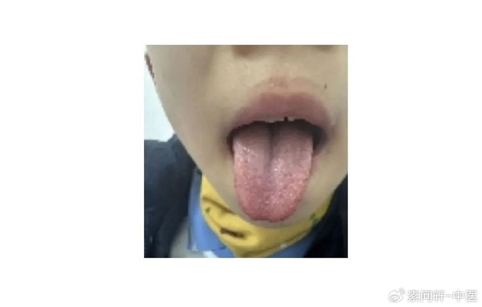 痒这个部位长水泡最近很多人中招今年湿比往年重一些