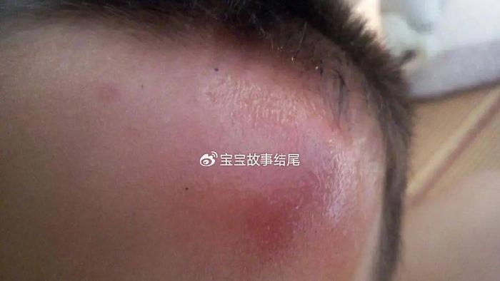 婴儿坠床后，有3件事要做好，关键时候能救命