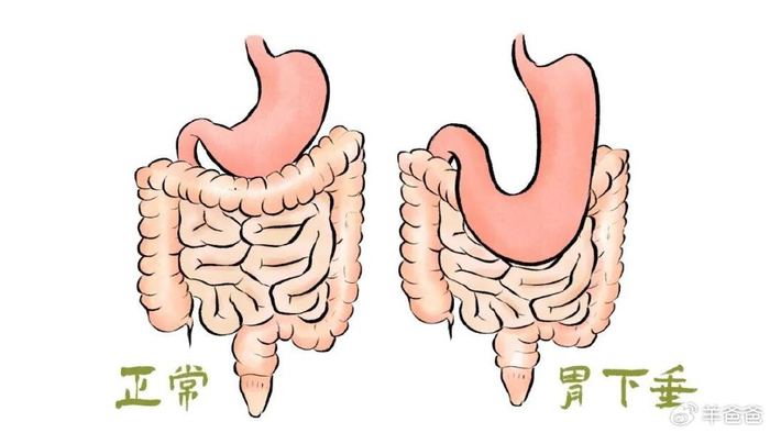 适合的症状还有:胃口不好,食欲不佳,或者吃东西消化能力稍弱,吃不了