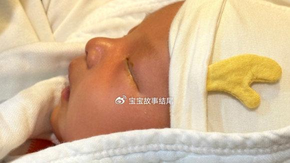 宝宝睡觉就出汗，妈妈忙着补钙，却把宝宝推向“深渊”