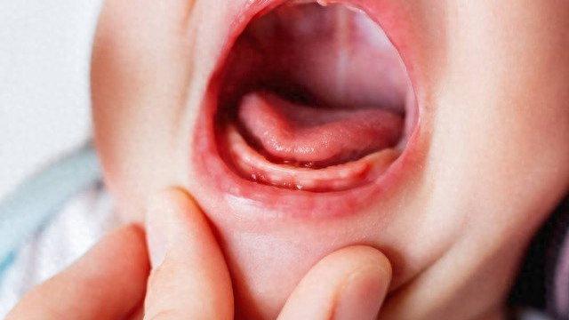 宝宝长牙全攻略：从第一个牙齿到最后一颗，月月看！