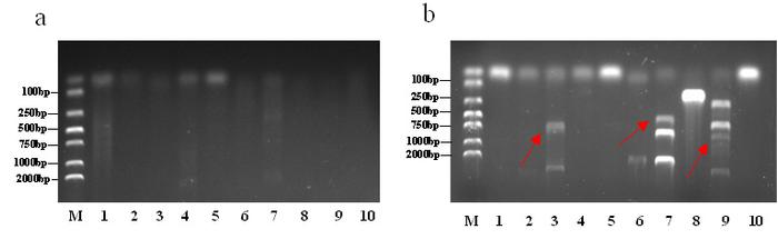 論文薦讀江南大學食品合成生物學與生物製造團隊痤瘡丙酸桿菌拮抗