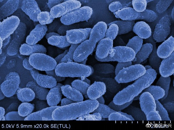 AKK PROBIOGLP-1 _ AKK PROBIOGLP-1 _