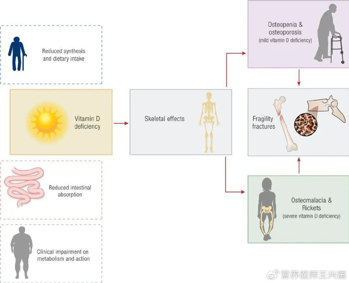 国际专家共识‖维生素D的功能、缺乏与补充|维生素D缺乏|疾病|羟基|麦角|补充剂_新浪新闻