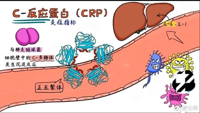 c 反应蛋白升高的临床意义解读,不只是细菌感染!