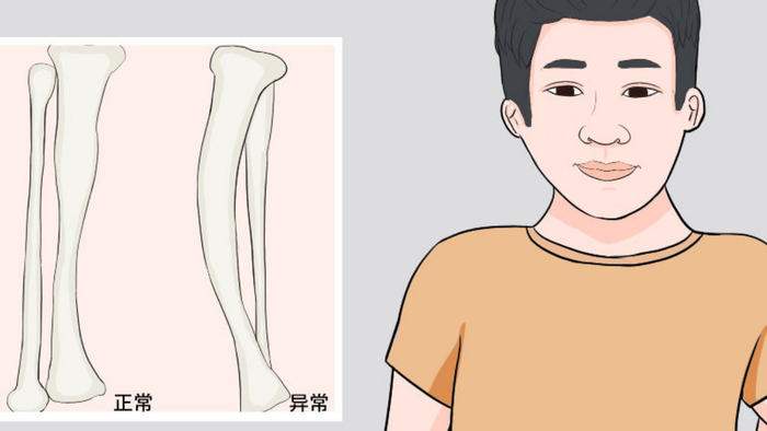 孩子不长个？这些原因你知道吗