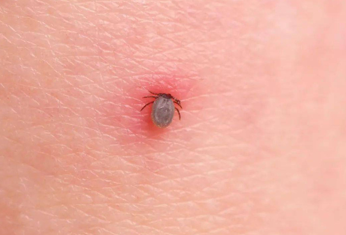 注意蜱虫,它不只会吸血,还会埋下"定时炸弹",吃肉就会触发