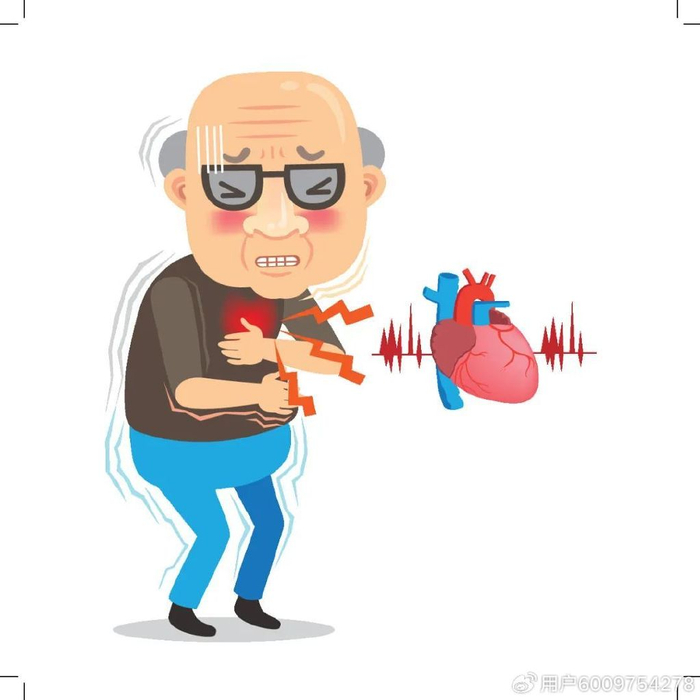 冠心病人最怕什么?速来学习避免中招