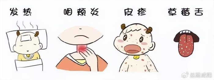 猩红热是一种由a组溶血性链球菌感染引发的急性呼吸道传染病,是我国