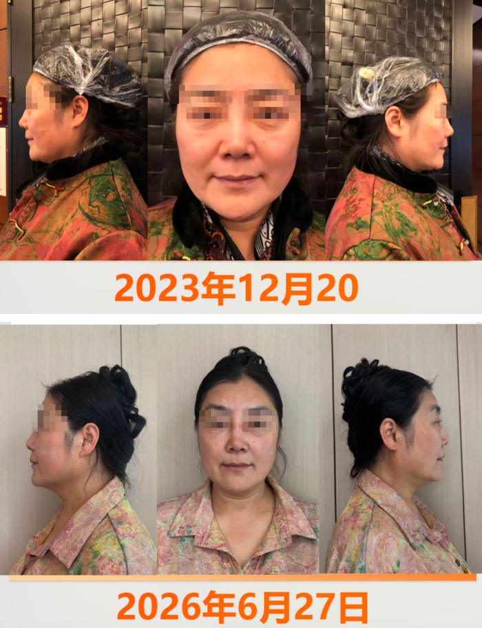 女子在杭州千和170万整歪鼻子?央视曾曝光虞美人无证行医(图5)