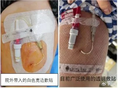 一例picc患者护理交班接时发现"隐藏"问题的案例分享|敷贴|护士|交接