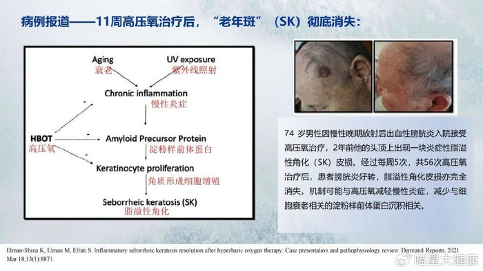 【走进高压氧疗】以色列科学家证实：90天吸入高压纯氧，生理年龄倒退|健康产业|医疗|高压氧_新浪新闻