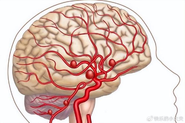 头部脑血管图图片