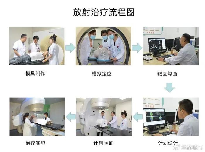 咸阳市中心医院:放疗走好这7步 肿瘤细胞大扫除