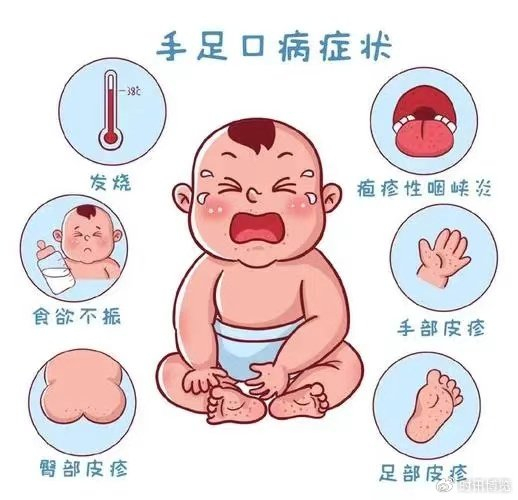 【健康科普】儿童手足口病高发季来临,我们如何做好预防?