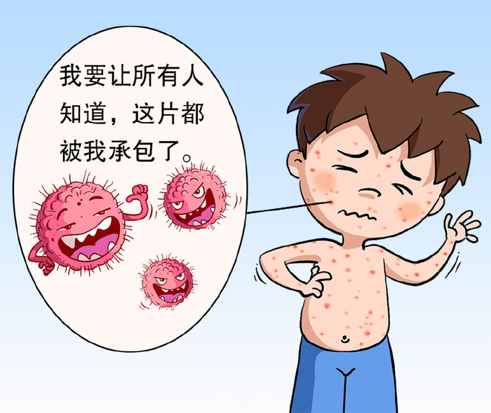 经2~3周潜伏期后,皮肤(以躯干处较常见)陆续出现斑丘疹,水疱疹,有的