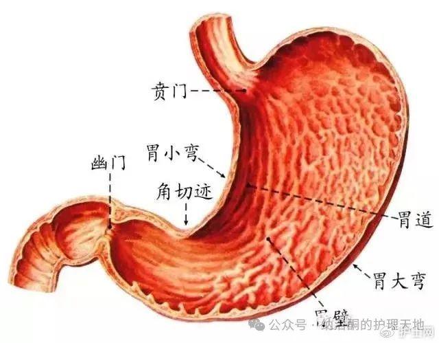 漏斗胃管洗胃法图片