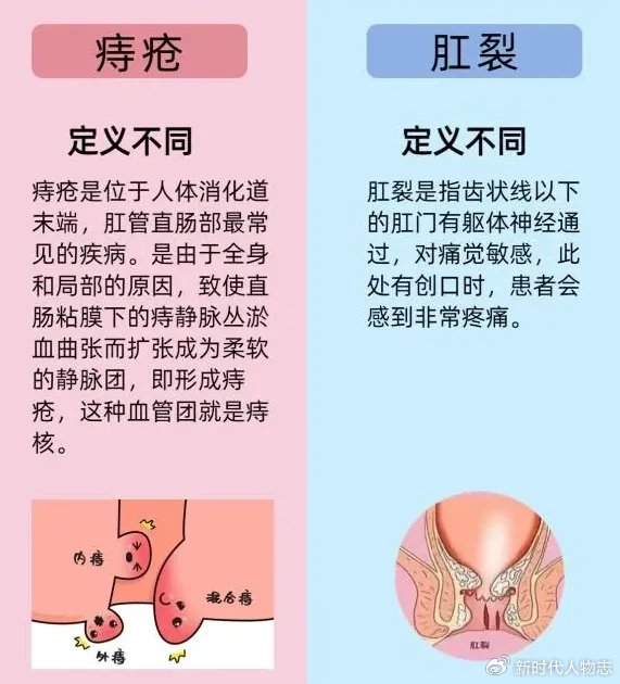 发病机理痔疮与肛裂,虽然都是肛门区域的常见疾病,但它们在发病机理