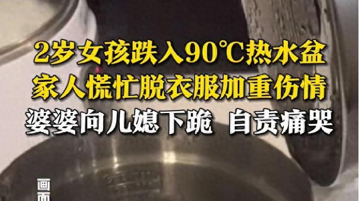 两岁孩子被90度热水烫伤，家长一个错误动作害娃毁容