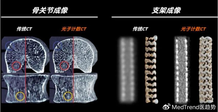 2025,影像设备赛道重回增长!__财经头条__新浪财经