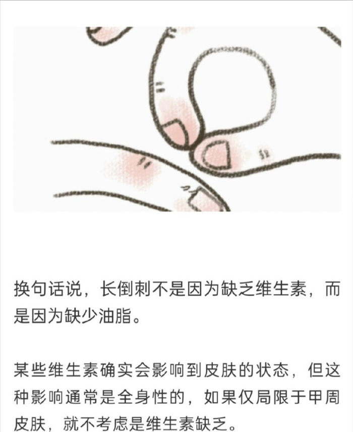 长倒刺真的是缺乏营养素吗?倒刺的科学处理方法__财经头条__新浪财经