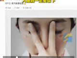 杨幂晒照脸疑似被蒸汽眼罩烫伤