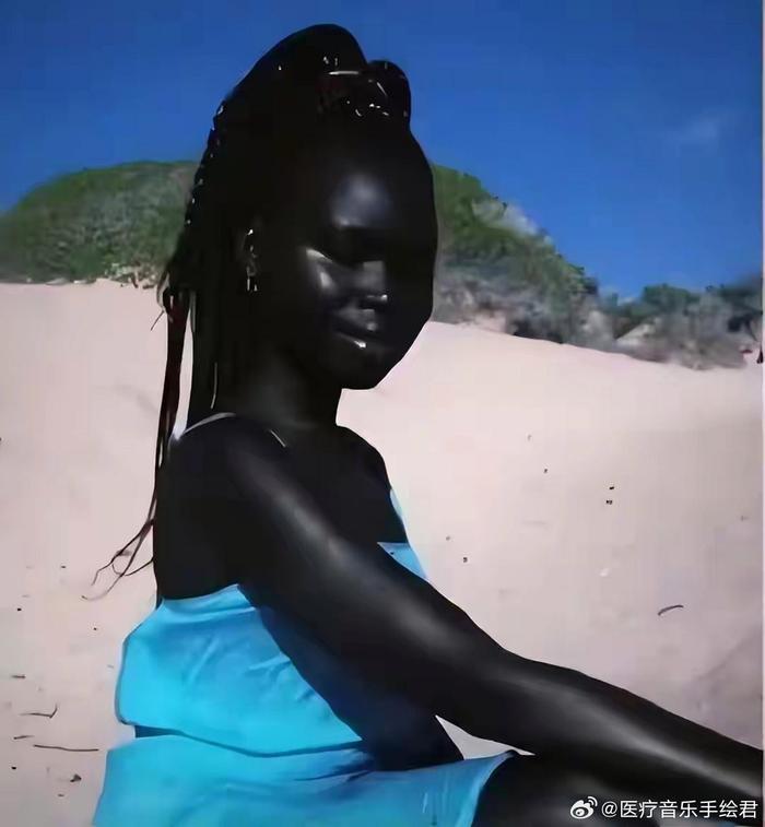 非洲黑人皮肤图片