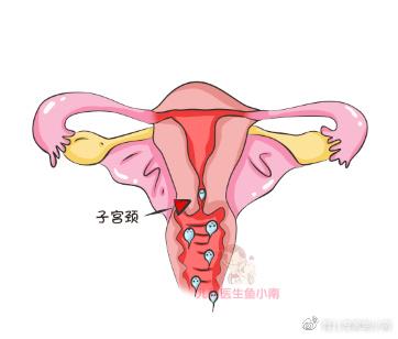 女性排卵期宫颈图片图片