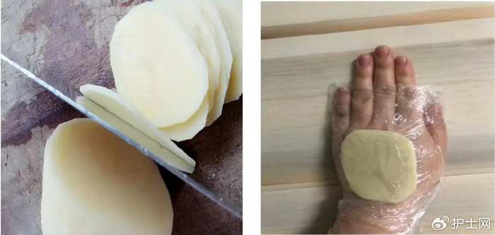 土豆|血管_新浪新闻