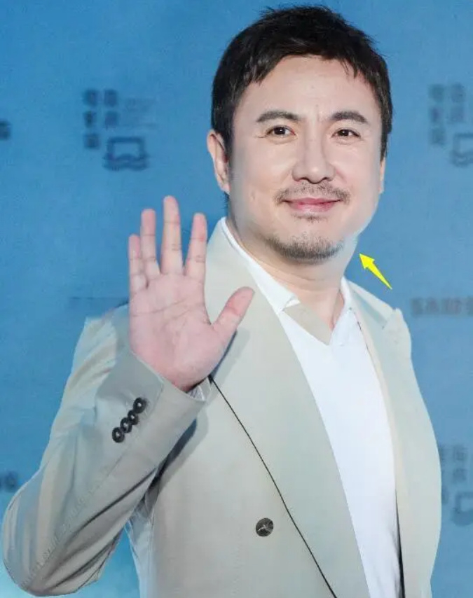 沈腾身体状况曝光!康复后再度亮相,引发网友热议