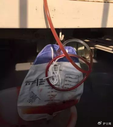 我们一起去到床边评估,患者尿袋及引流管内有约 50 ml 的血尿.