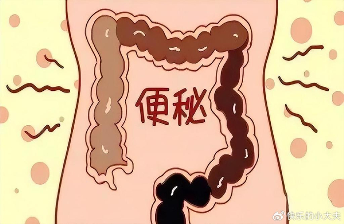 排便困扰不止?医生提示:治疗方法和8个预防,告别便秘烦恼!