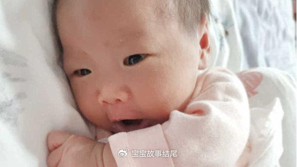 34天宝宝，湿疹不断出现，只因妈妈这一错误，家长自检