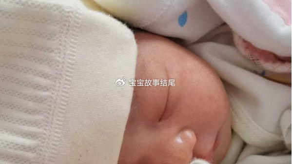 宝宝初次睡整觉，却查出脑缺氧，家长们要自检