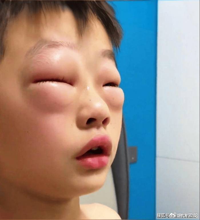 河南小学生一写作业就眼睛红肿,母亲不敢让写,网友却一眼看穿