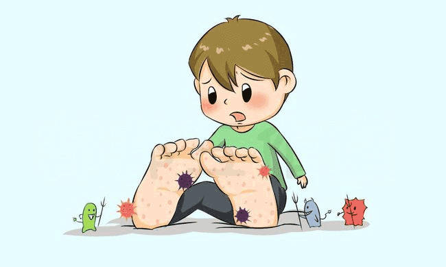 脚气,学名"足癣"(tinea pedis),是由真菌感染引起的一种常见皮肤病.